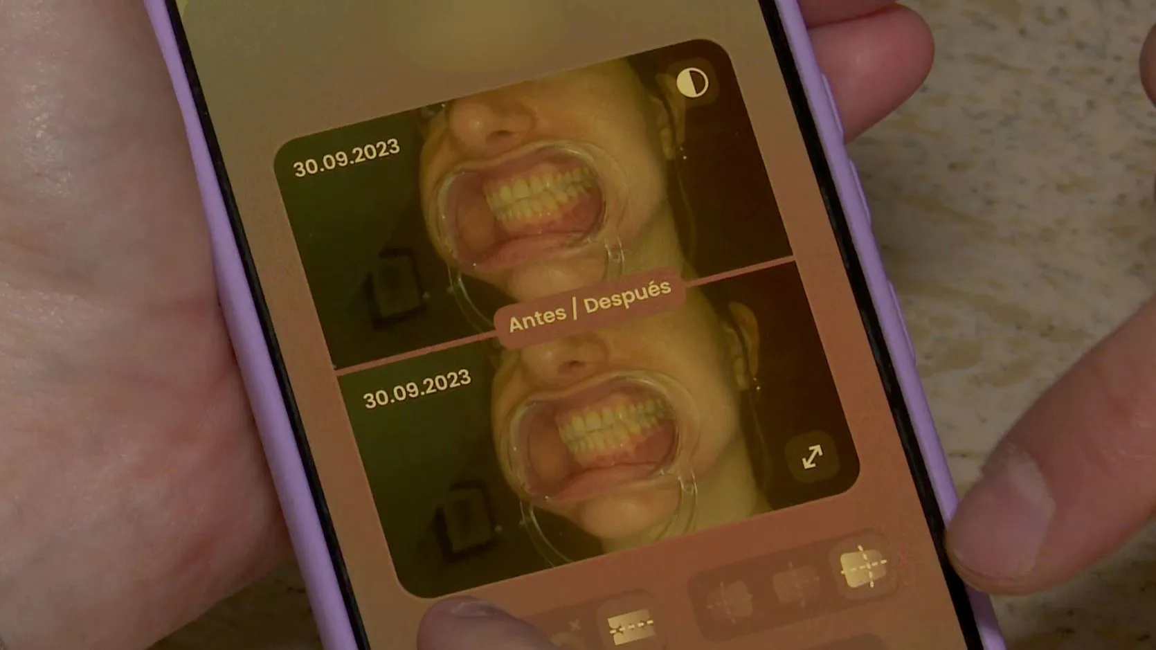Tratamientos dentales online. Tratamientos dentales online.