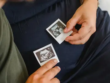 Ecografía de un bebé Ecografía de un bebé