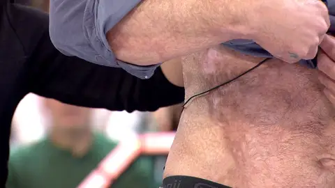 Ha sobrevivido gracias a piel artificial creada a partir de su ADN: "Yo daba por hecho que iba a morir" Ha sobrevivido gracias a piel artificial creada a partir de su ADN: "Yo daba por hecho que iba a morir"