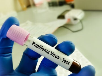 Análisis del VPH 