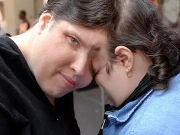 Los siameses Lori y George Schappell Los siameses Lori y George Schappell