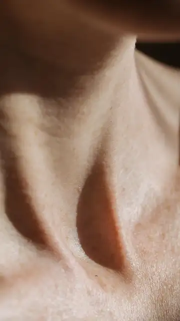 Piel sensible Piel sensible