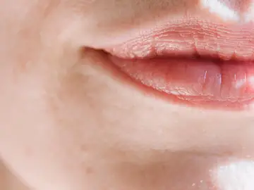 Labio Labio