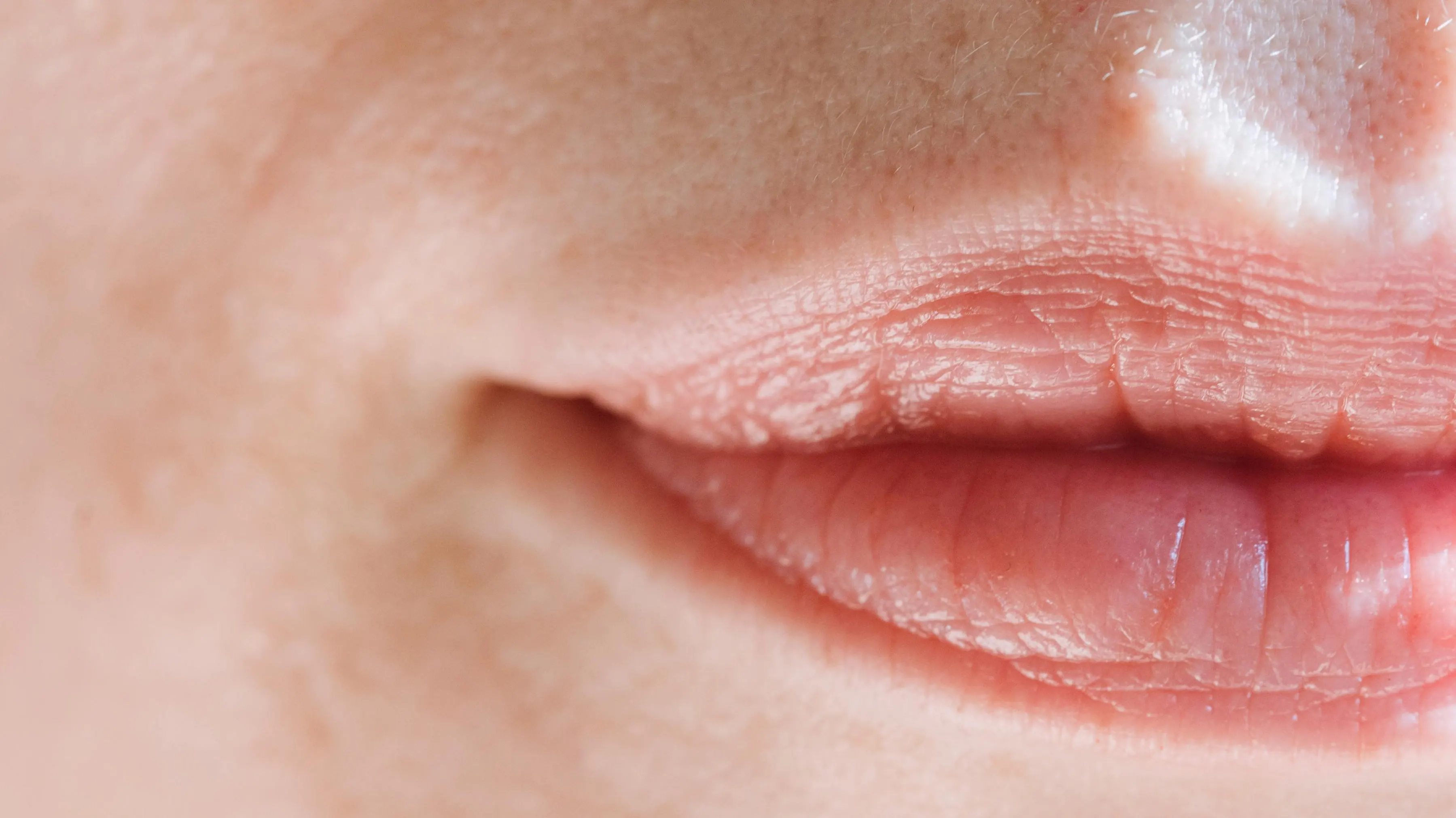 Labio Labio