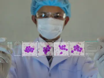 Investigación sobre la leucemia Investigación sobre la leucemia