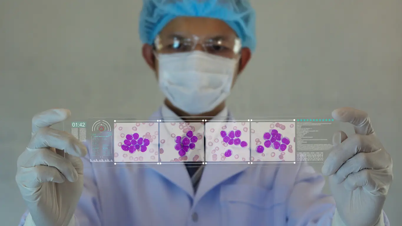 Investigación sobre la leucemia Investigación sobre la leucemia
