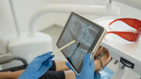 Radiografía bucal Radiografía bucal