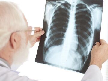 Un profesional sanitario interpreta una radiografía