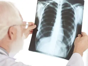 Un profesional sanitario interpreta una radiografía Un profesional sanitario interpreta una radiografía