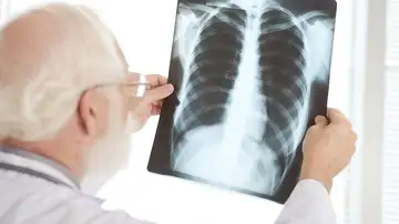 Un profesional sanitario interpreta una radiografía