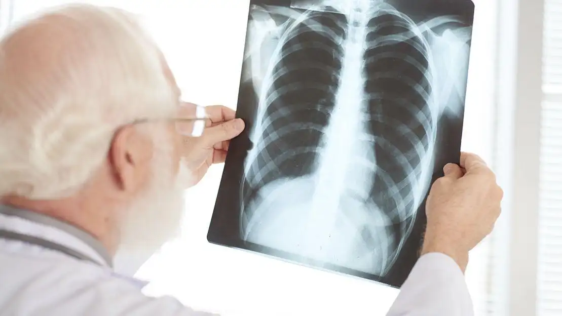 Un profesional sanitario interpreta una radiografía Un profesional sanitario interpreta una radiografía