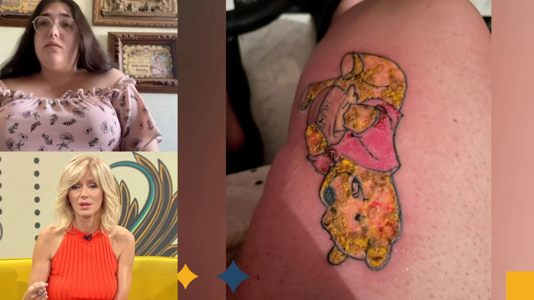 Riesgo tatuaje.
