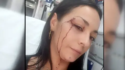 Cristina recibió una paliza de su vecina y amiga tras denunciarla por abandonar a su perro durante 15 días Cristina recibió una paliza de su vecina y amiga tras denunciarla por abandonar a su perro durante 15 días