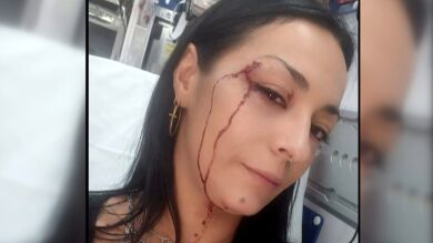 Cristina recibió una paliza de su vecina y amiga tras denunciarla por abandonar a su perro durante 15 días