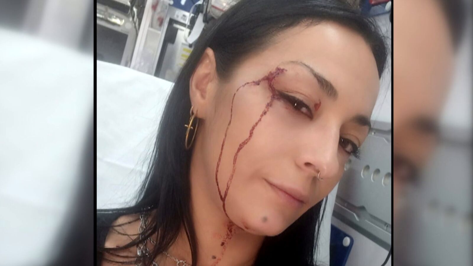 Cristina recibió una paliza de su vecina y amiga tras denunciarla por abandonar a su perro durante 15 días