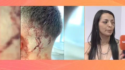 La presunta agresora de Cristina da su versión mientras las amenazas aumentan: "Temo que vuelva a atacar" La presunta agresora de Cristina da su versión mientras las amenazas aumentan: "Temo que vuelva a atacar"