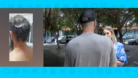 Atacado por su exjefe con pegamento. Atacado por su exjefe con pegamento.