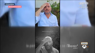 Estos son los peligros de la peligrosa moda viral del 'callo solar': 