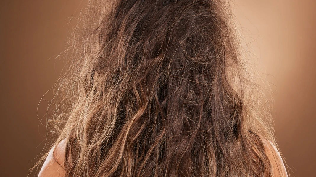 Pelo encrespado Pelo encrespado