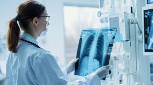 c&aacute;ncer de pulm&oacute;n, inmunoterapia