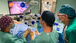 Médicos tratando el glaucoma