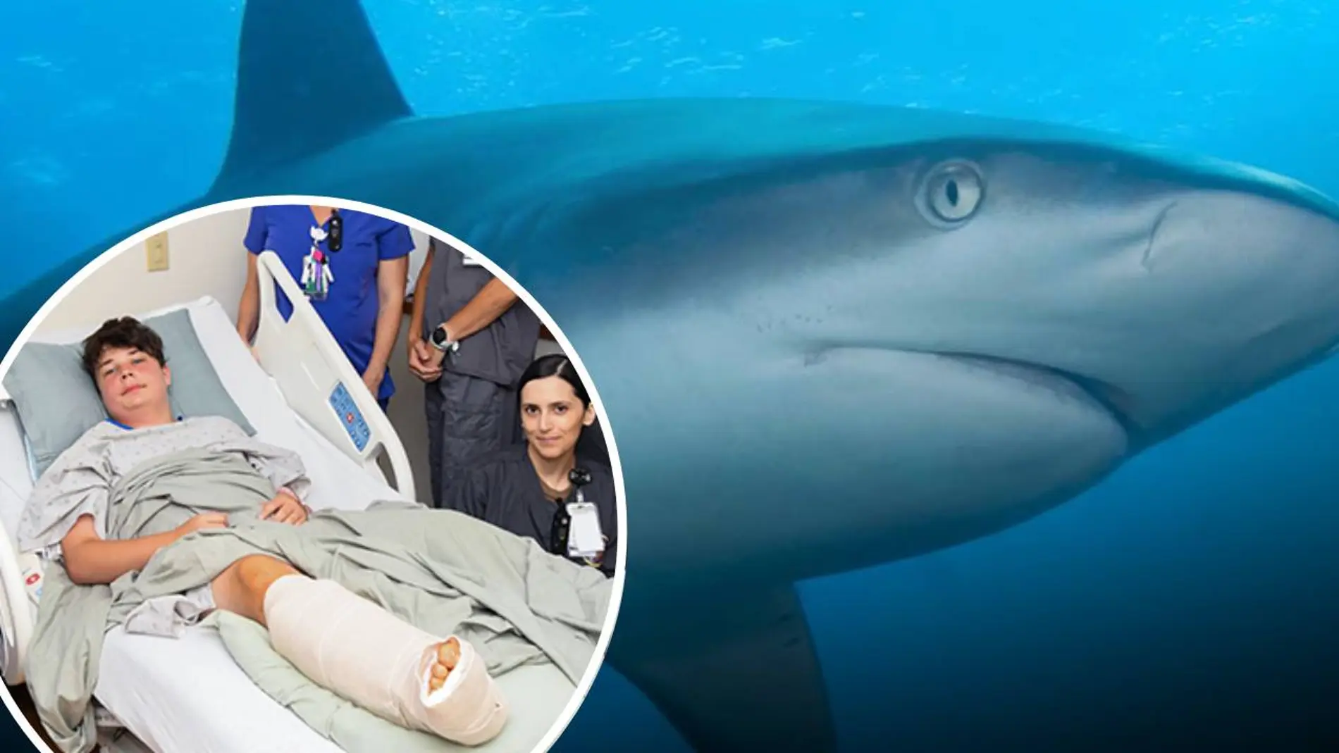 Brutalmente atacado por un tiburón Brutalmente atacado por un tiburón