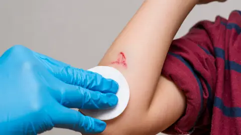 Un niño con una herida Un niño con una herida