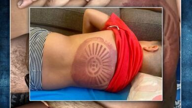 Un niño, succionado por la depuradora de una piscina sin socorrista, está en estado crítico