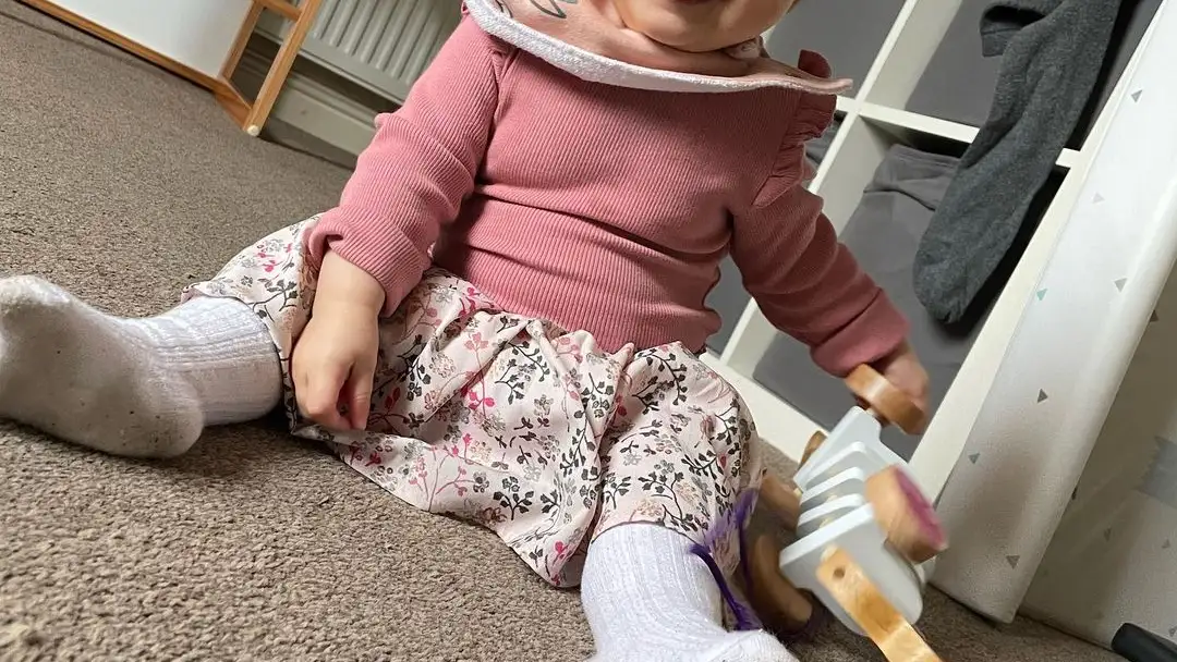 Aretria, la niña con una extraña enfermedad en los ojos Aretria, la niña con una extraña enfermedad en los ojos