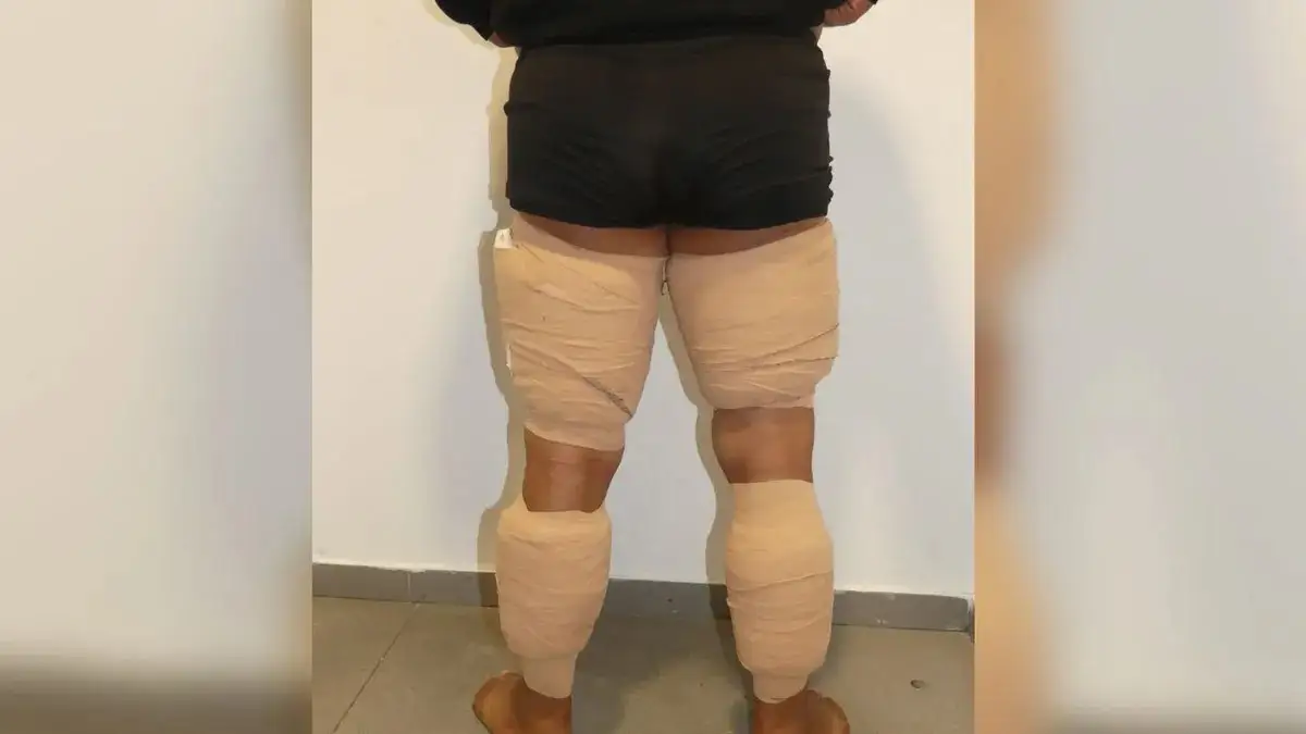 Cuatro detenidos por trafico de drogas en su interior y adheridas al cuerpo en el aeropuerto de Barcelona | Policía Nacional Hombre con cocaína pegada a sus piernas