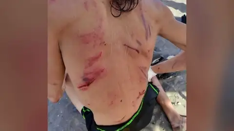 Se toma la justicia por su mano y apalea a un supuesto ladrón en una playa en Tenerife Se toma la justicia por su mano y apalea a un supuesto ladrón en una playa en Tenerife
