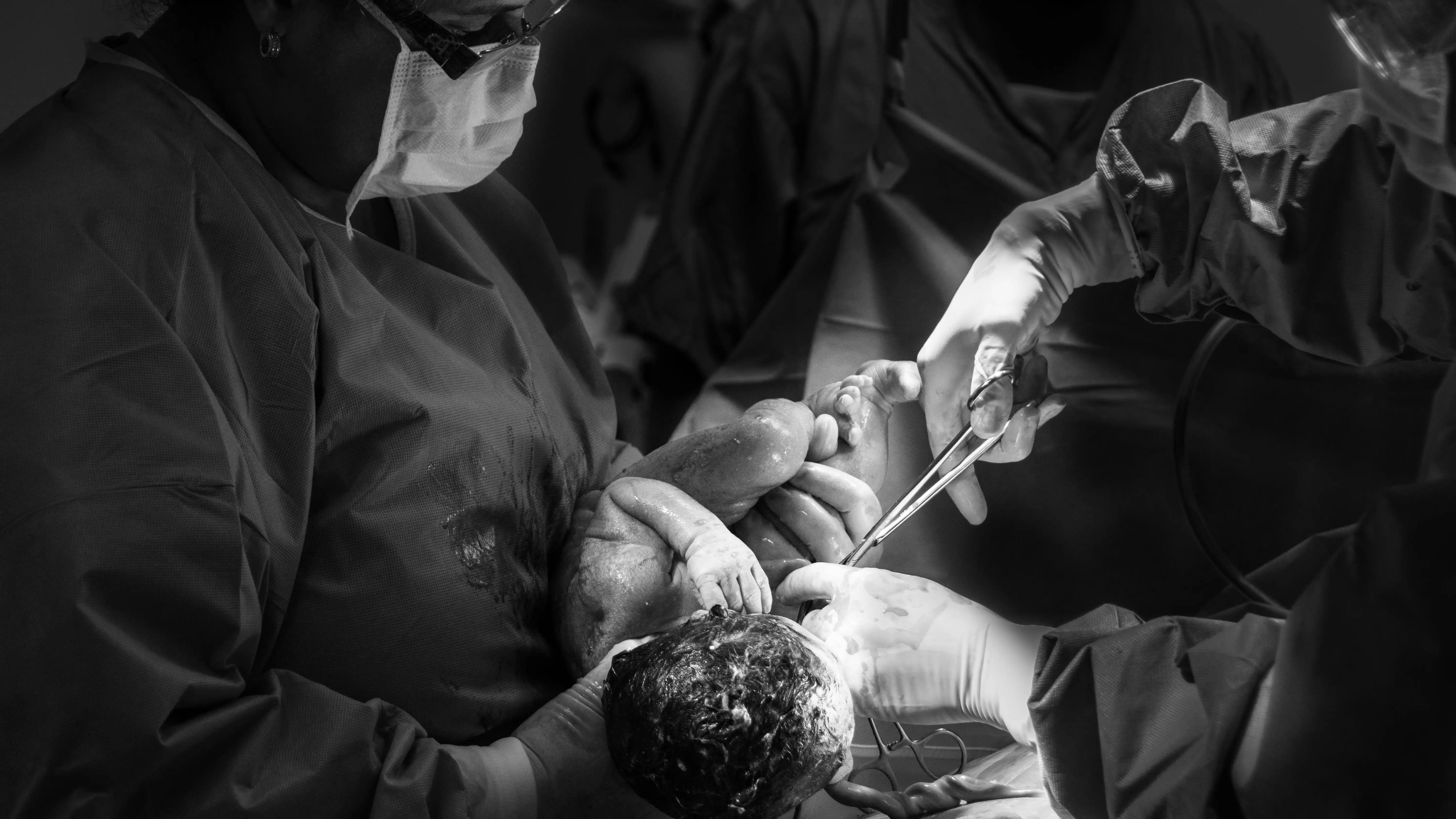 Imagen de archivo de un parto. 
