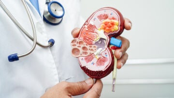 Maqueta del interior de un riñón