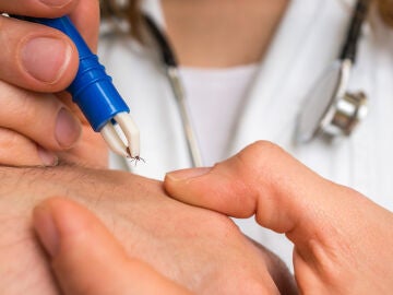 Dos estudios confirman que el inicio precoz del tratamiento contra la migraña mejora su evolución Dos estudios confirman que el inicio precoz del tratamiento contra la migraña mejora su evolución