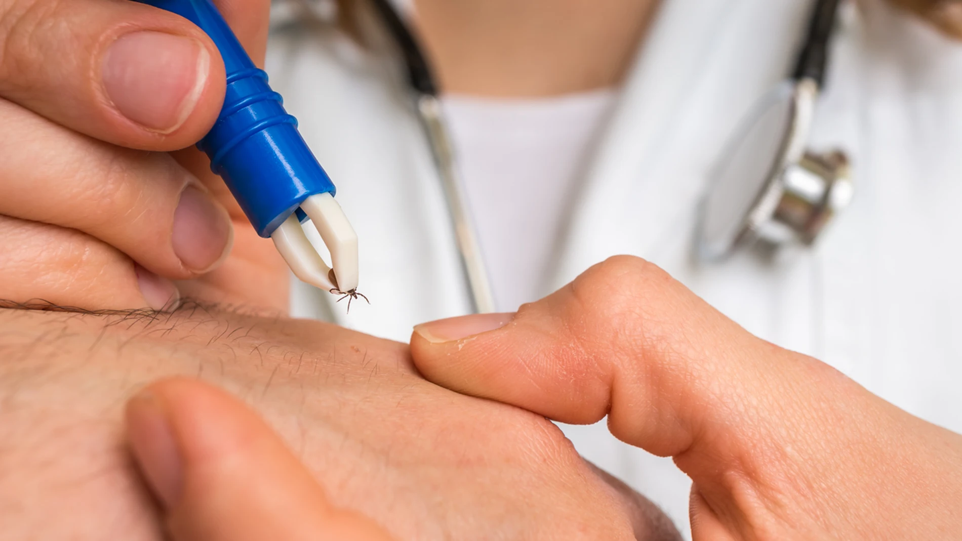 Dos estudios confirman que el inicio precoz del tratamiento contra la migraña mejora su evolución Dos estudios confirman que el inicio precoz del tratamiento contra la migraña mejora su evolución