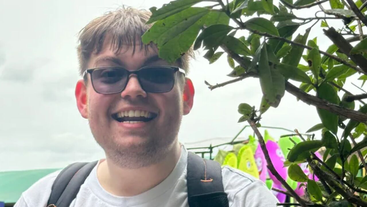 Milagro médico: un joven resucita después de 25 minutos muerto tras sufrir quemaduras solares