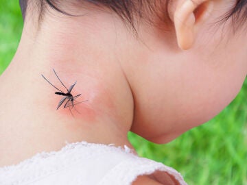 Cuello de un niño con un mosquito