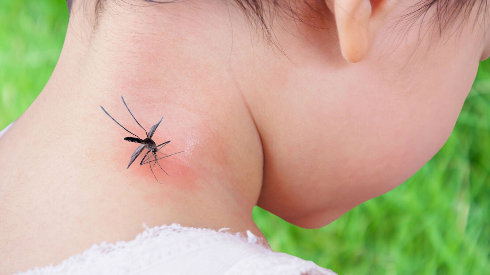 Picaduras de mosquitos en niños, bebés y embarazadas: Precauciones de una matrona