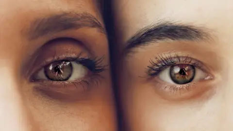 Ojos Ojos