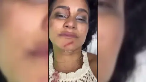 Acaba en urgencias tras una pelea por la mejor mesa de la discoteca: "Me rompieron una botella en la cara" Acaba en urgencias tras una pelea por la mejor mesa de la discoteca: "Me rompieron una botella en la cara"