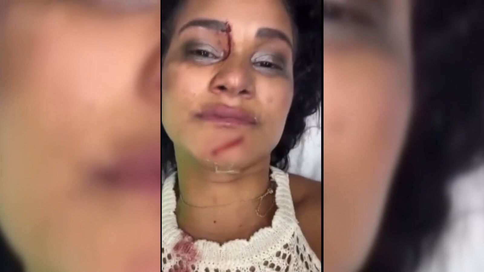 Acaba en urgencias tras una pelea por la mejor mesa de la discoteca: 
