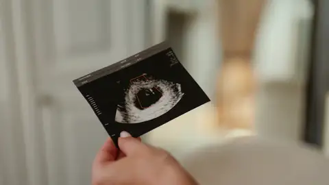 Bebé de Kumru Bebé de Kumru