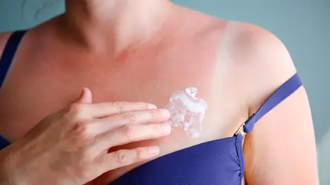 Mujer echándose crema Mujer echándose crema
