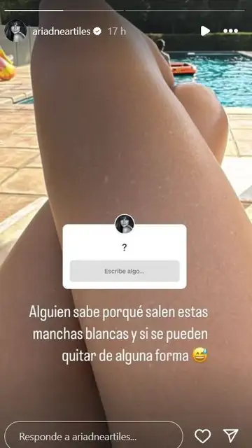 Ariadne Artiles muestra una foto de las manchas blancas Ariadne Artiles muestra una foto de las manchas blancas