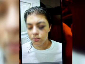 Una joven pasa un mes secuestrada por su pareja y atada a la cama: "Estaba totalmente desfigurada y olía fatal"