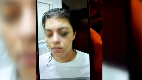 Una joven pasa un mes secuestrada por su pareja y atada a la cama: "Estaba totalmente desfigurada y olía fatal" Una joven pasa un mes secuestrada por su pareja y atada a la cama: "Estaba totalmente desfigurada y olía fatal"