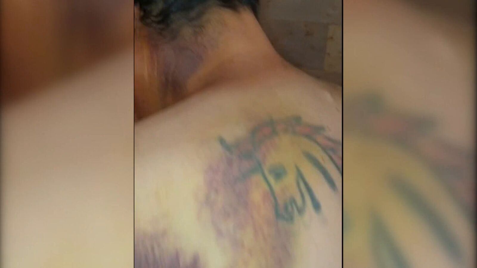 Javier, agredido en Urueña (Valladolid) por no llevar a su perro atado: 