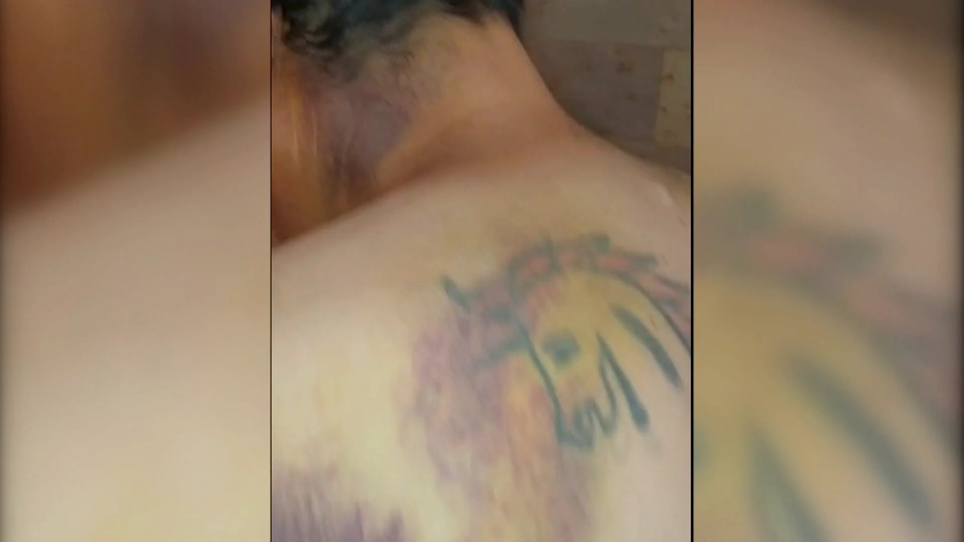 Javier, agredido en Urueña (Valladolid) por no llevar a su perro atado: "Me partió la muleta en la espalda"
