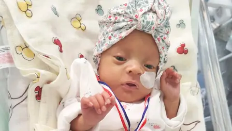 Melany, una bebé nacida el pasado 7 de abril con tan solo 22 semanas Melany, una bebé nacida el pasado 7 de abril con tan solo 22 semanas