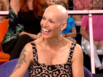 Dora Gálvez, con alopecia autoinmune, reivindica la existencia de mujeres calvas en la sociedad: "Yo me odiaba"